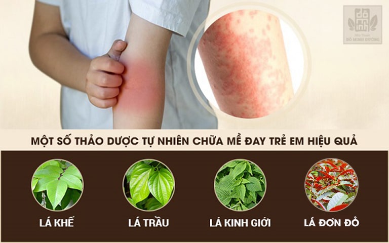 Dùng lá tắm để trị nổi mề đay ở trẻ là phương pháp được nhiều bậc cha mẹ tin dùng