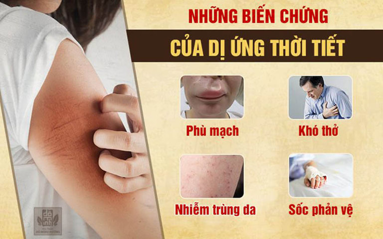 Nếu không xử lý kịp thời và đúng cách, dị ứng thời tiết gây ra những biến chứng nguy hiểm